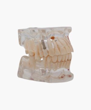 orthodontic model-20