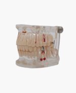 orthodontic model-22