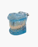 orthodontic model-24