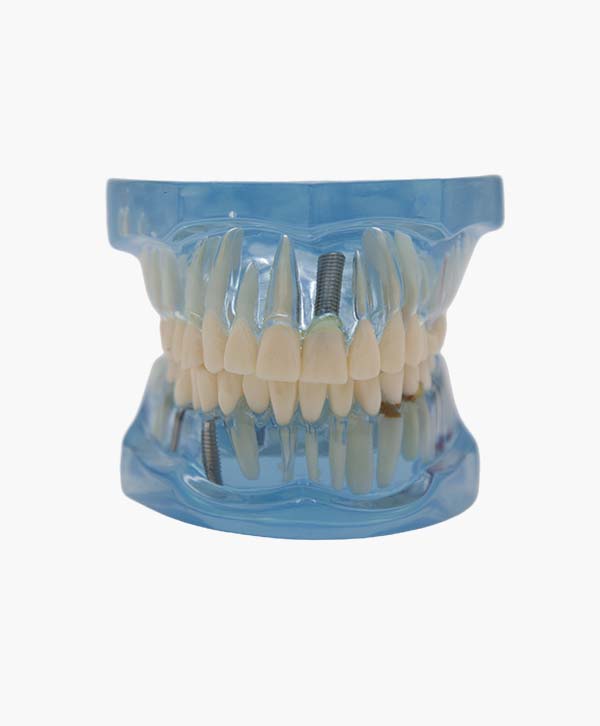 orthodontic model-25