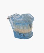 orthodontic model-26