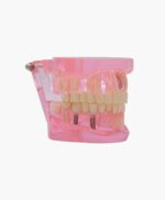 orthodontic model-30