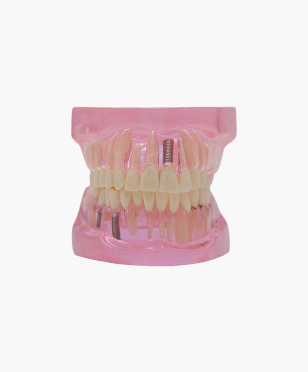 orthodontic model-31