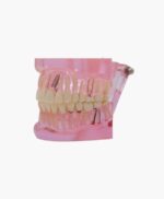 orthodontic model-32