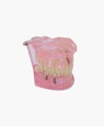 orthodontic model-34