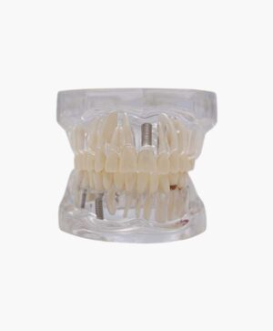 orthodontic model-39