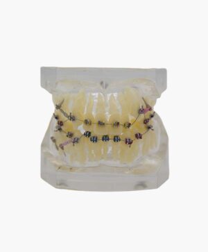 orthodontic model-5