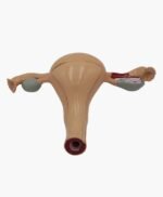 uterus and ovaries-10