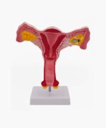 uterus and ovaries-3