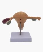 uterus and ovaries-9
