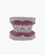 dental model-4