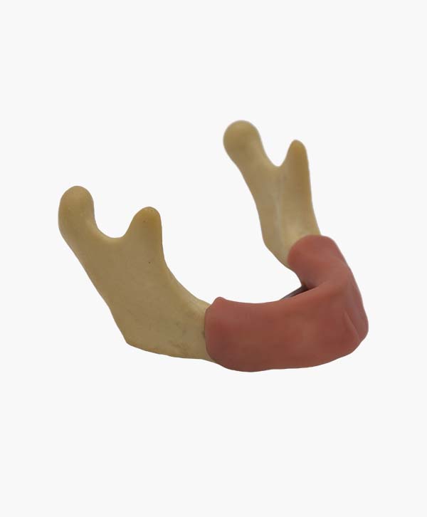 mandibular bone-6