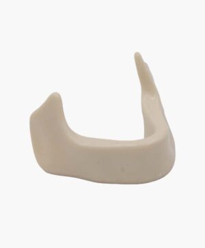 mandibular bone-9