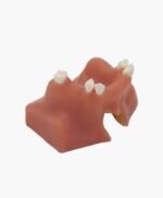 maxillary sinus lifting-7