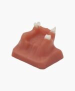 maxillary sinus lifting-9
