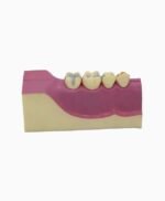 right lower tooth-1