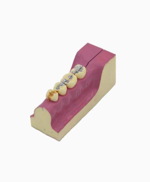 2 Times Right Lower Tooth Detachable Model – Feiman