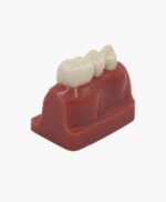 teeth implanting model-5