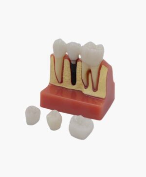 teeth implanting model-8