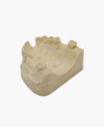 upper jaw-31