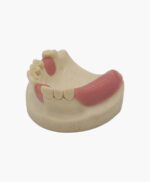 upper jaw-4