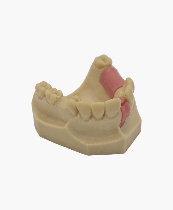 upper jaw-8